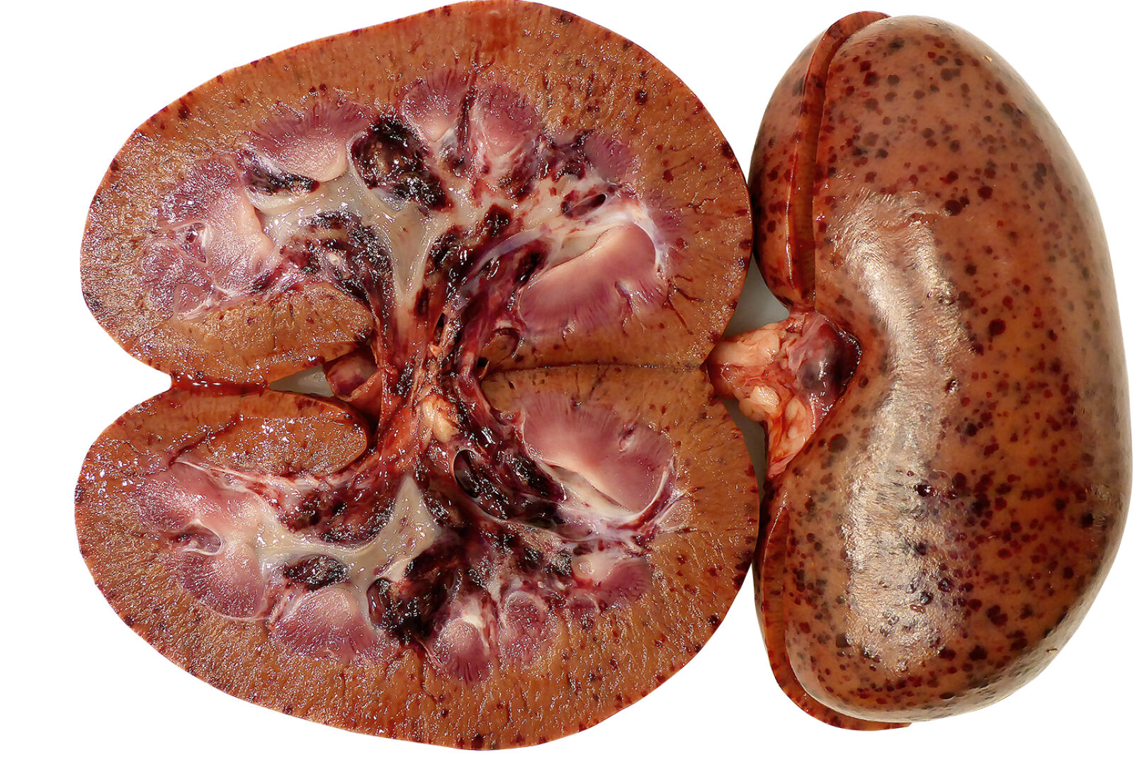 Die für ASP typischen pathologisch-anatomischen Veränderungen sind Blutungen in den Organen - © Pikalo/Blome