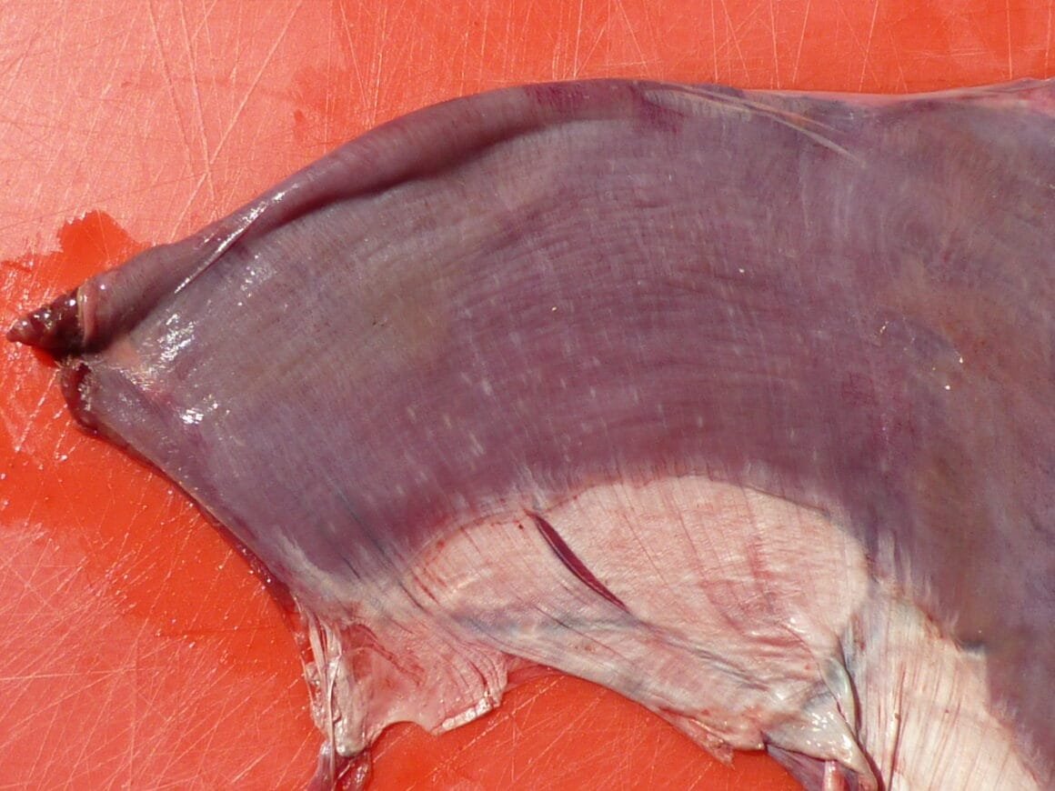 Krankheit
